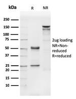 CD31/PECAM-1 (Endothelial Cell Marker) Antibody in SDS-PAGE (SDS-PAGE)
