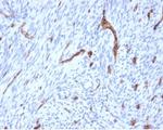 CD31/PECAM-1 (Endothelial Cell Marker) Antibody in Immunohistochemistry (Paraffin) (IHC (P))