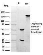 CD31/PECAM-1 (Endothelial Cell Marker) Antibody in SDS-PAGE (SDS-PAGE)