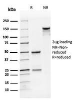 CD31/PECAM-1 (Endothelial Cell Marker) Antibody in SDS-PAGE (SDS-PAGE)
