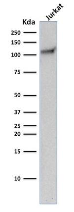 CD31/PECAM-1 (Endothelial Cell Marker) Antibody in Western Blot (WB)