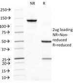 CD31/PECAM-1 (Endothelial Cell Marker) Antibody in SDS-PAGE (SDS-PAGE)