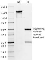 CD31/PECAM-1 (Endothelial Cell Marker) Antibody in SDS-PAGE (SDS-PAGE)