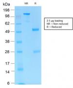 CD31/PECAM-1 (Endothelial Cell Marker) Antibody in SDS-PAGE (SDS-PAGE)