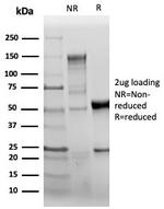 CD31/PECAM-1 (Endothelial Cell Marker) Antibody in SDS-PAGE (SDS-PAGE)
