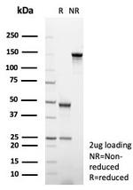 CD31/PECAM-1 (Endothelial Cell Marker) Antibody in SDS-PAGE (SDS-PAGE)