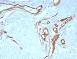 CD31/PECAM-1 (Endothelial Cell Marker) Recombinant Rabbit Monoclonal Antibody (C31/8243R)
