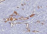 CD31/PECAM-1 (Endothelial Cell Marker) Recombinant Rabbit Monoclonal Antibody (C31/8377R)