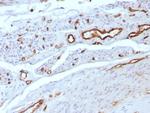 CD31/PECAM-1 (Endothelial Cell Marker) Recombinant Rabbit Monoclonal Antibody (C31/8592R)