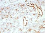 CD31/PECAM-1 (Endothelial Cell Marker) Recombinant Rabbit Monoclonal Antibody (C31/8828R)