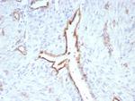 CD31/PECAM-1 (Endothelial Cell Marker) Recombinant Rabbit Monoclonal Antibody (C31/9224R)