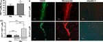Claudin 1 Antibody in Immunohistochemistry (IHC)