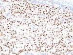 Progesterone Receptor (Marker of Progestin Dependence) Monoclonal Antibody (PR500)