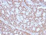 Progesterone Receptor (Marker of Progestin Dependence) Antibody in Immunohistochemistry (Paraffin) (IHC (P))