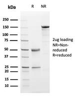 Progesterone Receptor (Marker of Progestin Dependence) Antibody in SDS-PAGE (SDS-PAGE)