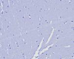 Progesterone Receptor (Marker of Progestin Dependence) Antibody in Immunohistochemistry (Paraffin) (IHC (P))