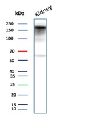 p170/MDR1/CD243 Antibody in Western Blot (WB)