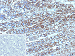 p170/MDR1/CD243 Monoclonal Antibody (ABCB1/9307)