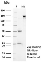 p170/MDR1/CD243 Antibody in SDS-PAGE (SDS-PAGE)