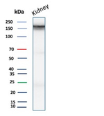 p170/MDR1/CD243 Antibody in Western Blot (WB)