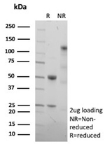 p170/MDR1/CD243 Antibody in SDS-PAGE (SDS-PAGE)