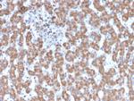 Prohibitin (Mitochondrial Marker) Antibody in Immunohistochemistry (Paraffin) (IHC (P))