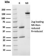 Prohibitin (Mitochondrial Marker) Antibody in SDS-PAGE (SDS-PAGE)