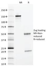 Alpha-1-Antitrypsin (SERPINA1) Antibody in SDS-PAGE (SDS-PAGE)