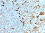 Alpha-1-Antitrypsin (SERPINA1) Monoclonal Antibody (AAT, 1378)