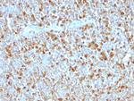 Alpha-1-Antitrypsin (SERPINA1) Monoclonal Antibody (AAT, 1379)