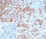 Alpha-1-Antitrypsin (SERPINA1) (Hepatocellular and Histiocytic Marker) Antibody in Immunohistochemistry (Paraffin) (IHC (P))
