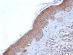 SERPINB5/Maspin Antibody in Immunohistochemistry (Paraffin) (IHC (P))