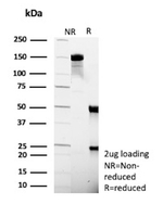 SERPINB5/Maspin (Tumor Suppressor & Epithelial Biomarker) Antibody in SDS-PAGE (SDS-PAGE)