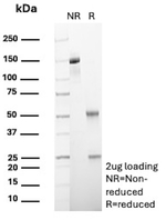 SERPINB5/Maspin (Tumor Suppressor & Epithelial Biomarker) Antibody in SDS-PAGE (SDS-PAGE)