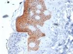 SERPINB5/Maspin Antibody in Immunohistochemistry (Paraffin) (IHC (P))