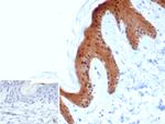 SERPINB5/Maspin Antibody in Immunohistochemistry (Paraffin) (IHC (P))