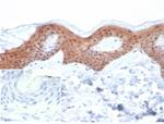 SERPINB5/Maspin Antibody in Immunohistochemistry (Paraffin) (IHC (P))