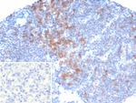 PIK3CD Monoclonal Antibody (PIK3CD/4639)