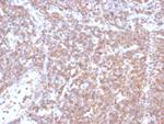 PLK1 Antibody in Immunohistochemistry (Paraffin) (IHC (P))