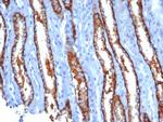 IL20RA (Interleukin 20 Receptor Subunit Alpha) Antibody in Immunohistochemistry (Paraffin) (IHC (P))