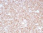 PMS2 (Postmeiotic Segregation Increased 2) Recombinant Rabbit Monoclonal Antibody (PMS2/8224R)
