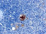 TRAcP (Tartrate-Resistant Acid Phosphatase) (Hairy Cell Leukemia Marker) Monoclonal Antibody (SPM601)