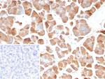 Pancreatic lipase/PNLIP Monoclonal Antibody (PNLIP/8913)
