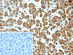 Pancreatic lipase/PNLIP Monoclonal Antibody (PNLIP/9038)