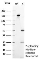 Pancreatic lipase/PNLIP Antibody in SDS-PAGE (SDS-PAGE)