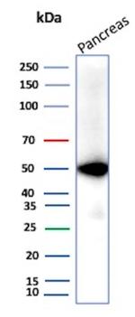 Pancreatic lipase/PNLIP Antibody in Western Blot (WB)