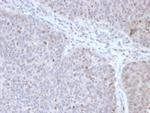 POLE3/CHRAC17 Monoclonal Antibody (PCRP-POLE3-2F10)