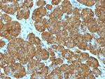 Cytochrome C (Mitochondrial Marker) Monoclonal Antibody (CYCS/1010)