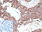 TREM2 (Triggering Receptor Expressed On Myeloid Cells 2) Monoclonal Antibody (TREM2/7210)