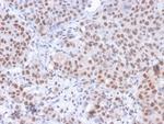 Phospho-RNA pol II CTD (Ser5) Monoclonal Antibody (CTD 8A7)